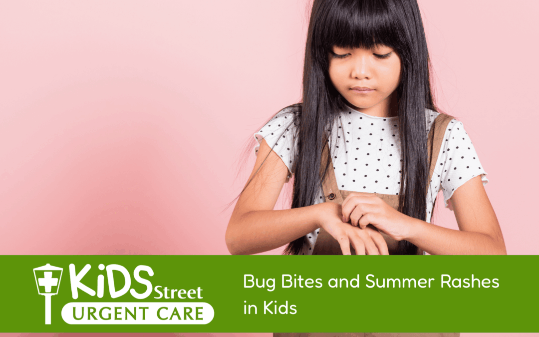Bug Bites, Stings, and Summer Rashes in Kids