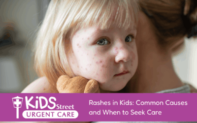 Rashes in Kids: Common Causes and When to Seek Care