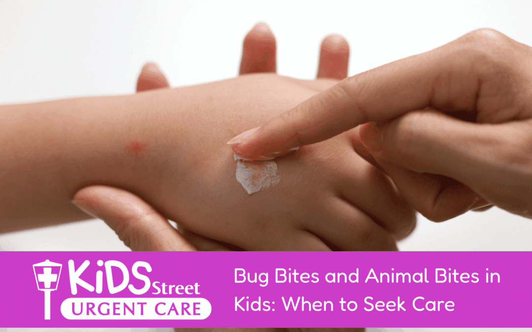 Bug Bites and Animal Bites in Kids: When to Seek Care