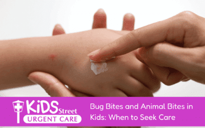 Bug Bites and Animal Bites in Kids: When to Seek Care